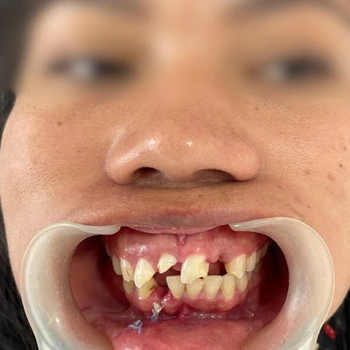 diseño de sonrisa Pereira