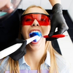 Blanqueamiento dental en Bogotá
