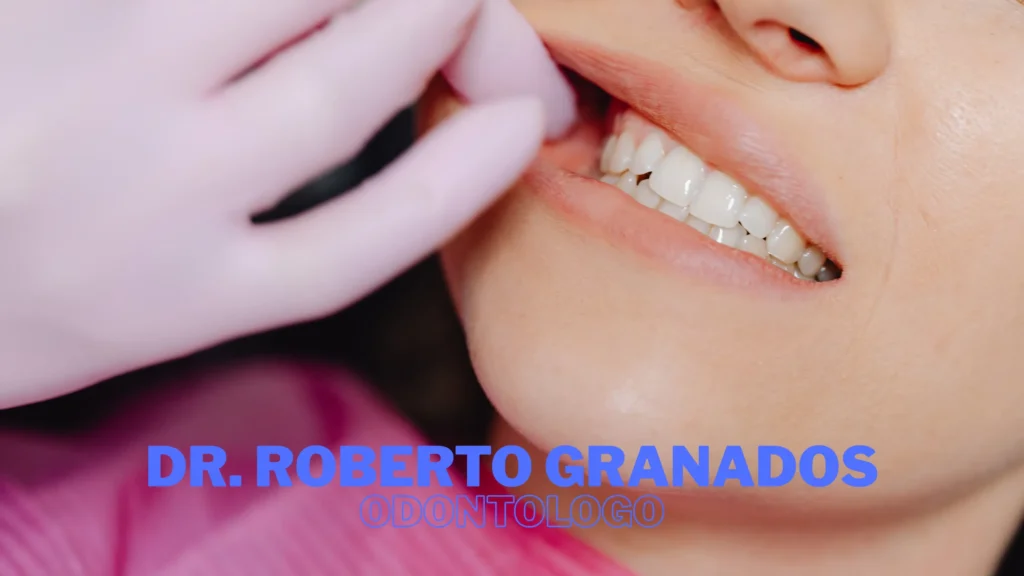 Blanqueamiento dental en Chapinero Bogotá