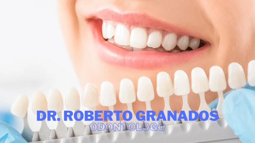 Diseño de Sonrisa en Bogotá