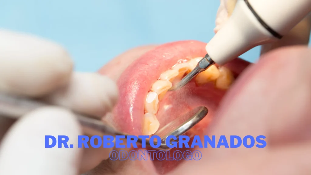 Mejores Clínicas de Implantes Dentales en Bogotá