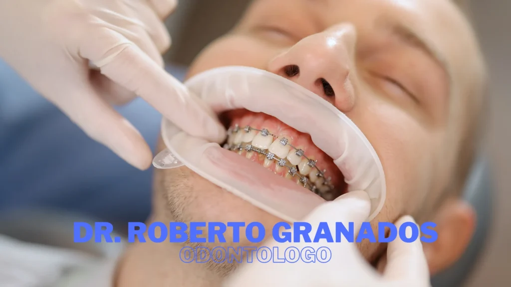 Diseño de Sonrisa en Antonio Nariño Bogotá