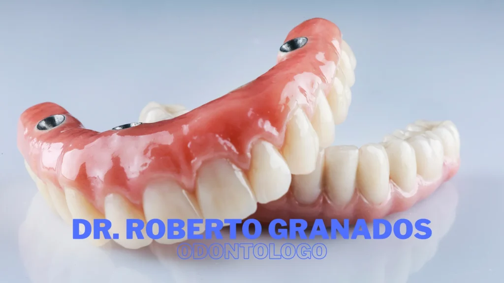 Diseño de Sonrisa en Antonio Nariño Bogotá