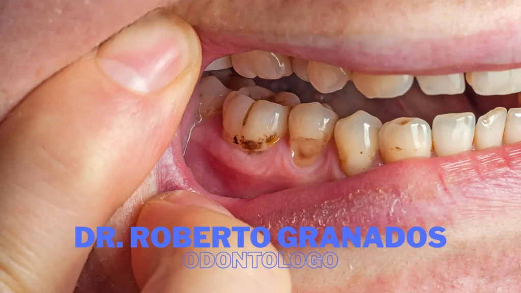 Mejores Clínicas de Implantes Dentales en Bogotá