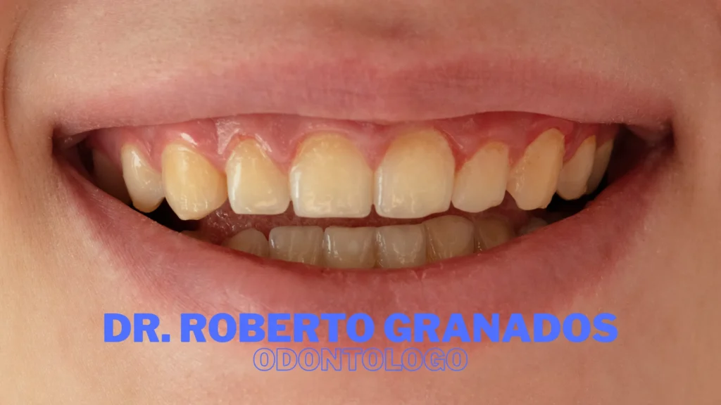 Mejores Clínicas de Implantes Dentales en Bogotá