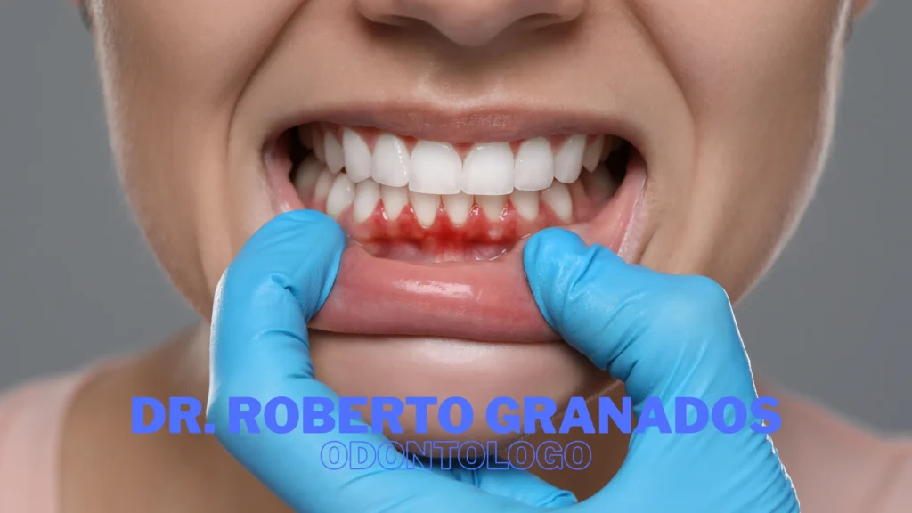 Diseño de Sonrisa en Bogotá