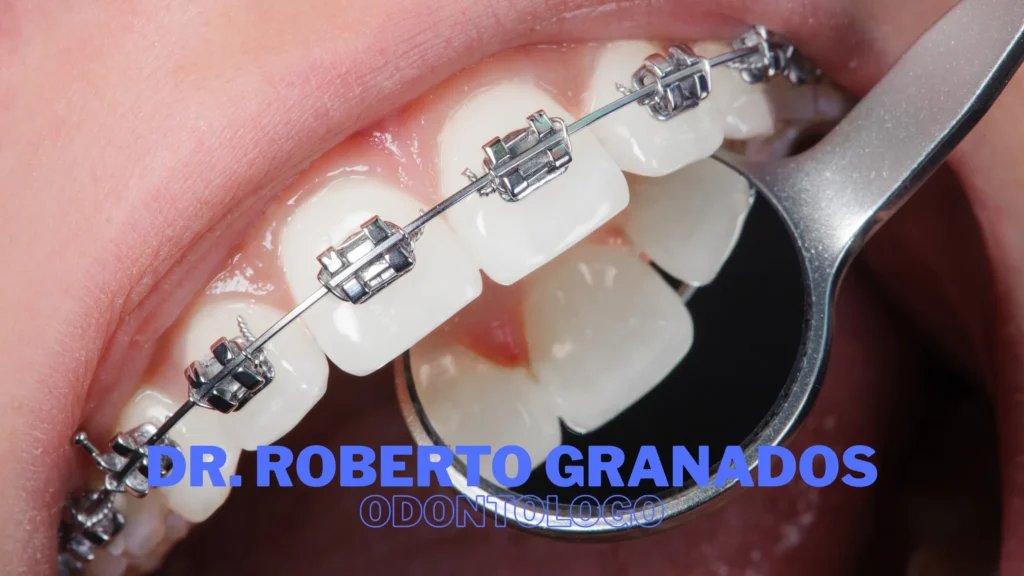 Ortodoncia en Chapinero Bogotá Dr. Roberto Granados
