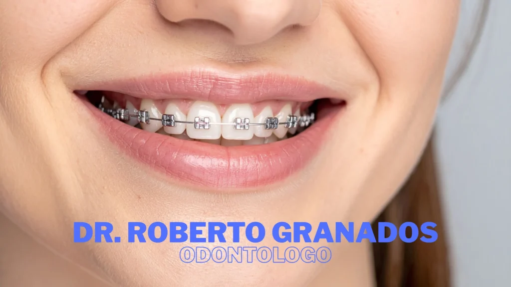 Mejores Clínicas de Implantes Dentales en Bogotá