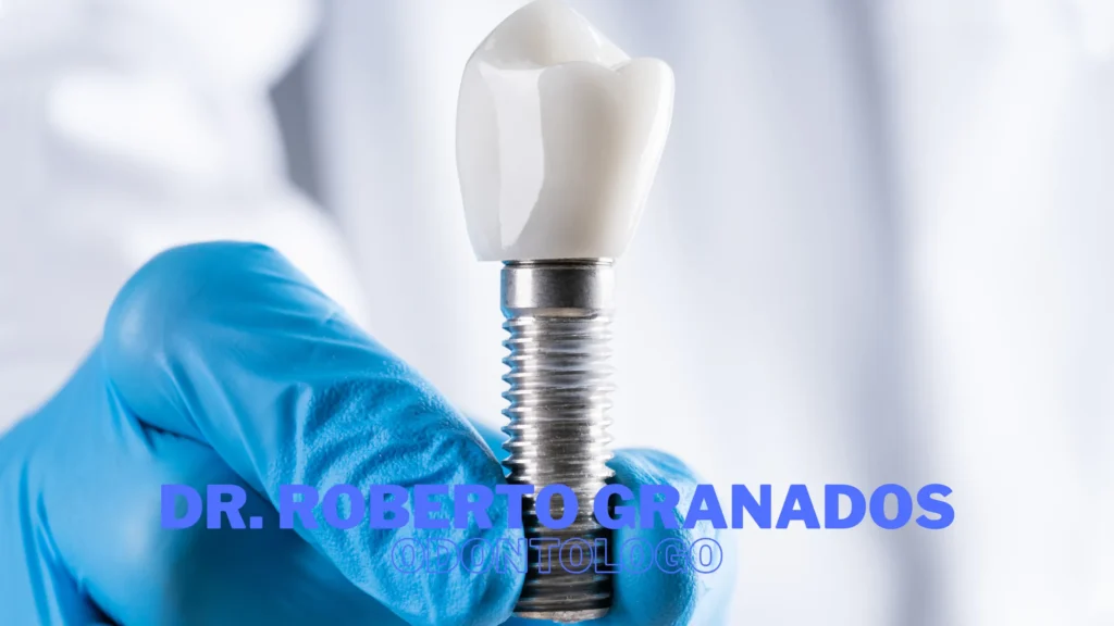 Coronas sobre Implantes en La Candelaria Bogotá