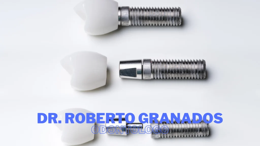 Coronas sobre Implantes en La Candelaria Bogotá