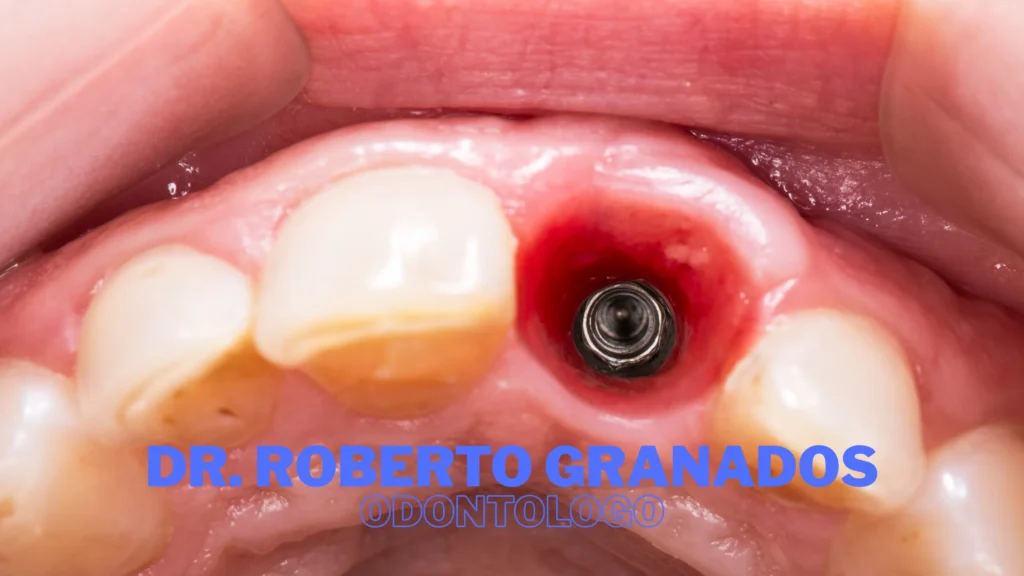 Odontología en Pereira