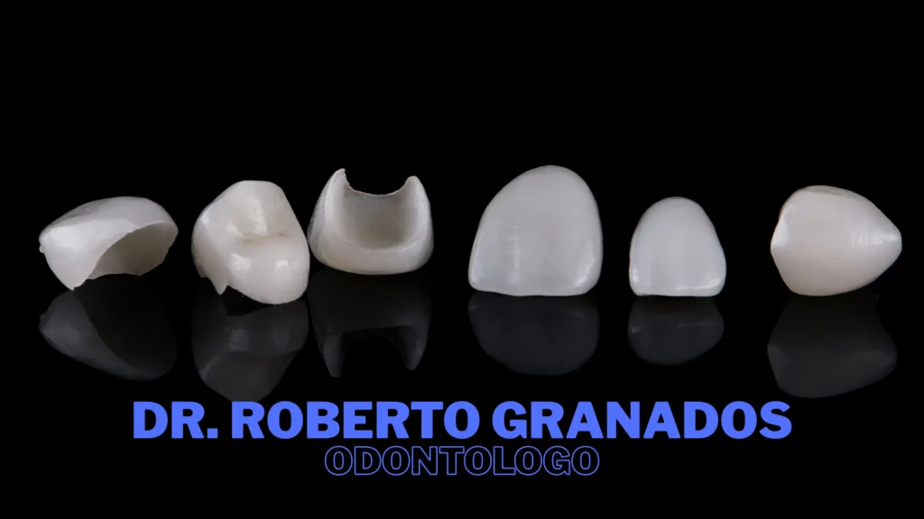 Diseño de Sonrisa en Antonio Nariño Bogotá