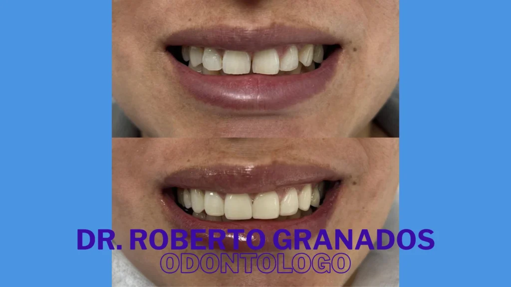 Diseño de Sonrisa Económico en Bogotá