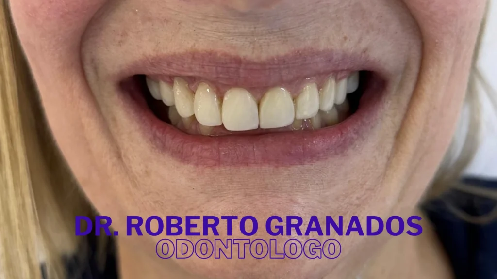 Diseño de Sonrisa Económico en Bogotá