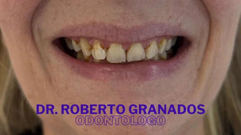Diseño de Sonrisa Económico en Bogotá