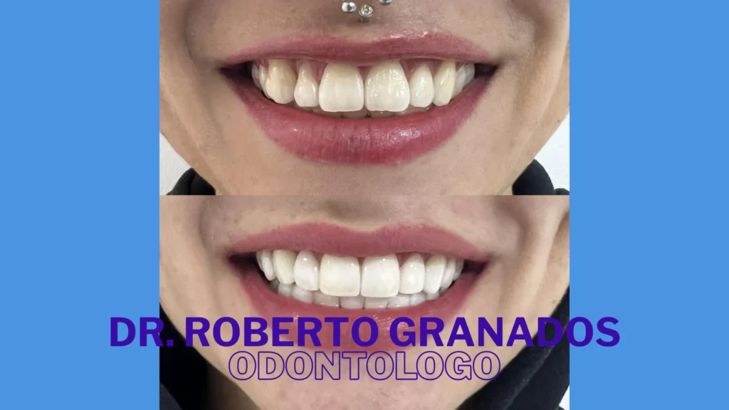 Diseño de Sonrisa Económico en Bogotá