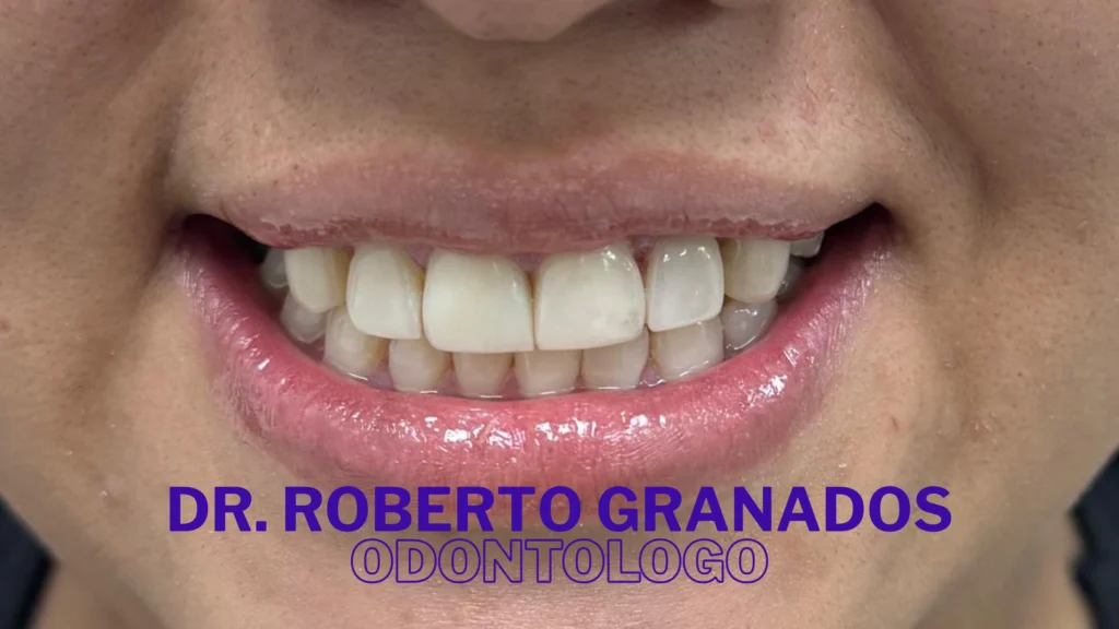Diseño de Sonrisa Económico en Bogotá