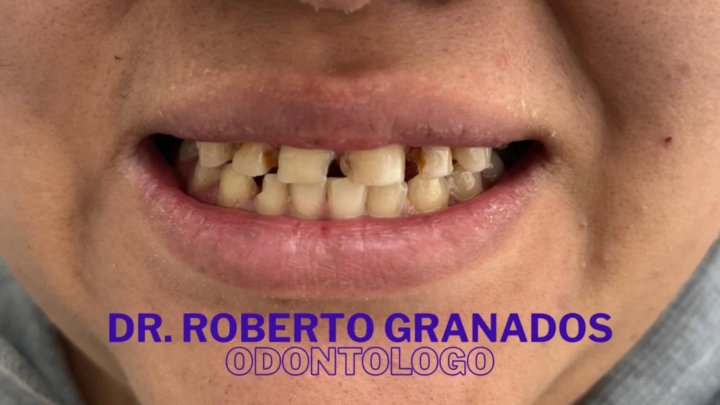 Diseño de Sonrisa Económico en Bogotá