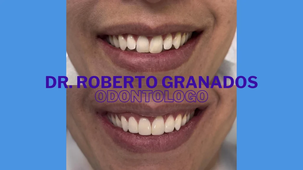 Diseño de Sonrisa Económico en Bogotá
