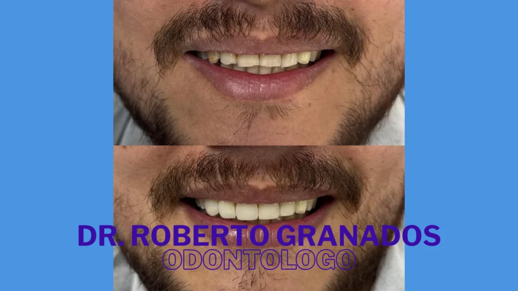 Diseño de Sonrisa Económico en Bogotá